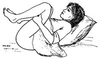 Figur 3  McRoberts man&oslash;ver utf&oslash;res med maksimal fleksjon i hofte og kneledd. Illustrasjon Ellinor M. Hoff