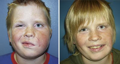 Olav i 2002 og i 2004. Begge foto Lars Salemark
