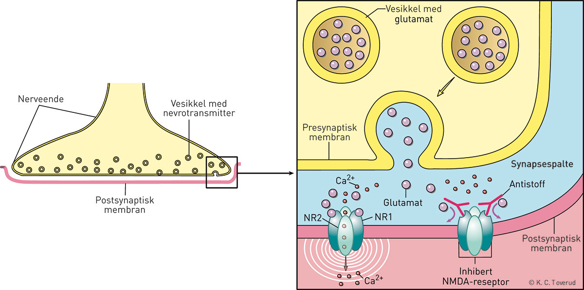 Figur 3  Skjematisk fremstilling av glutamatreseptorer av NMDA (N-metyl D-aspartat)-typen i hjernen. NMDA-reseptoren best&aring;r&hellip;