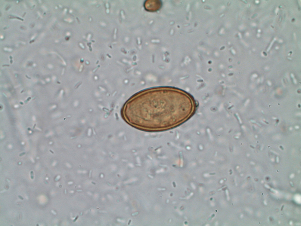 Figur 2  H. heterophyes-egg. Foto: John Olav Alvsv&aring;g