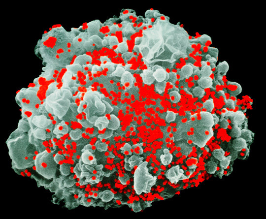 Illustrasjonsfoto: Science Photo Library/NTB scanpix