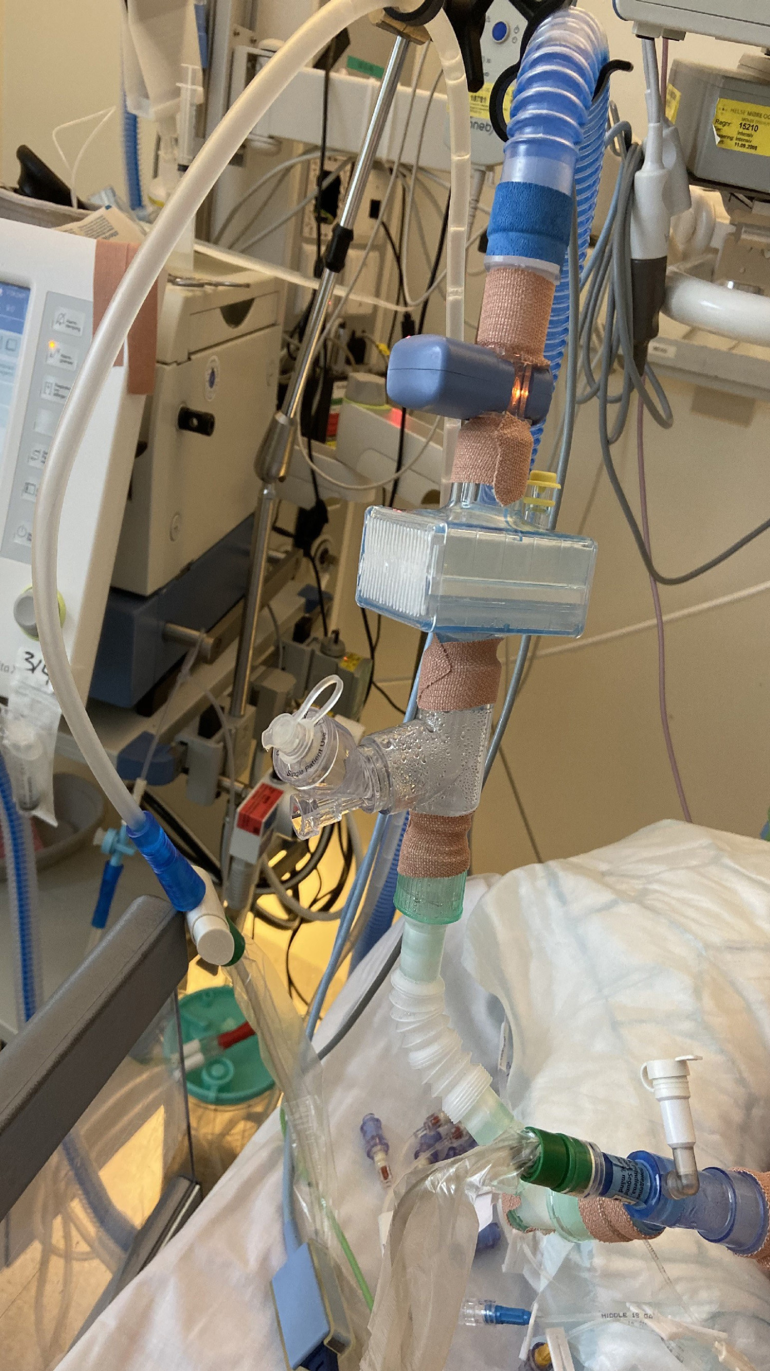Figur 1 Teiping av respiratorkoblinger for &aring; unng&aring; spredning av aerosoler i rommet ved aksidentell frakobling