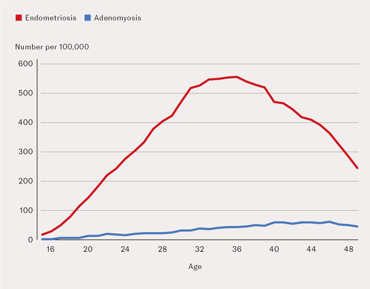 Figure 3 Number of women with endometriosis and adenomyosis per 100,000 women, registered in the specialist health service&hellip;