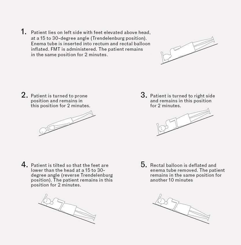 Figure 2 The patient was repositioned on the examination table according to a tested procedure to ensure distribution of the&hellip;