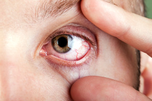 Illustrasjonsfoto: ia_64/iStock.