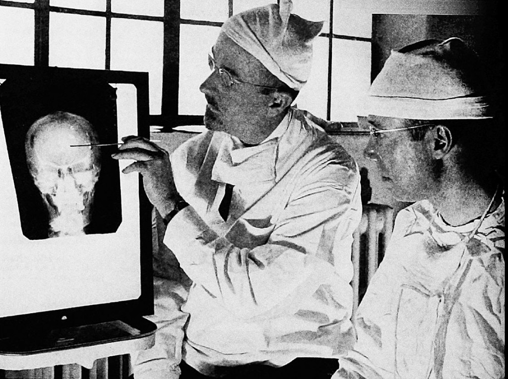 Figur 1 Dr. Walter Freeman II (t.v.), og Dr. James W. Watts studerer et r&oslash;ntgenbilde f&oslash;r en operasjon (2). Foto: Public&hellip;