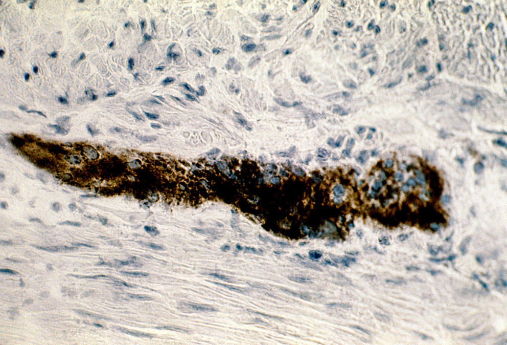 Nerver i tarm sett ved lysmikroskopi. Foto: Science Photo Library / NTB