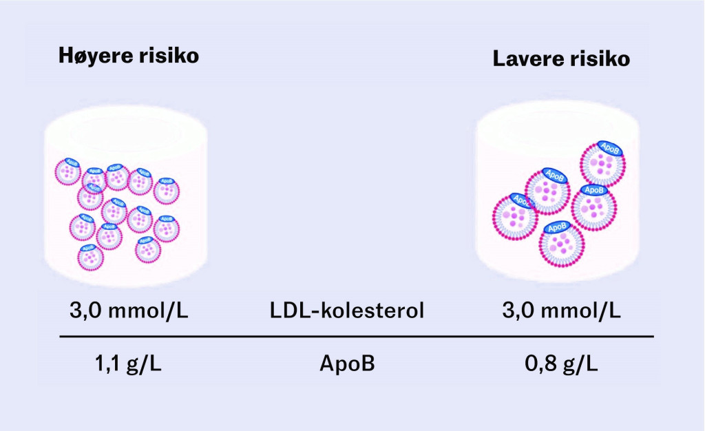 Figur 2 Hypotetisk illustrasjon av to pasienter med likt niv&aring; av LDL-kolesterol, men ulik partikkelmengde (apoB). Pasienten&hellip;