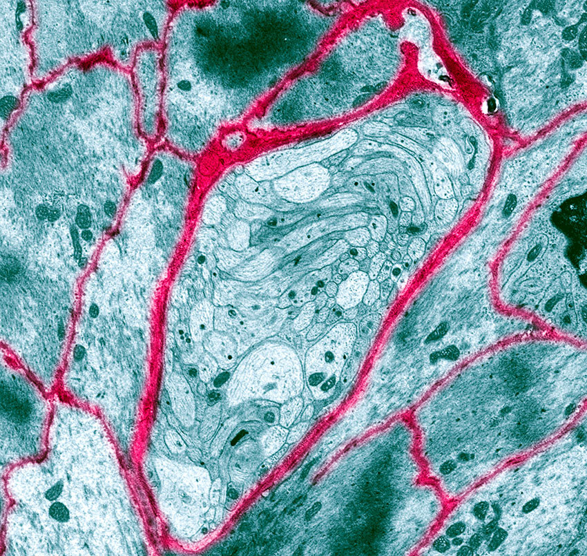 Umyelinisert nervefiber i tarmen, observert gjennom transmisjonselektronmikroskop (TEM). Foto: Science Photo Library / NTB